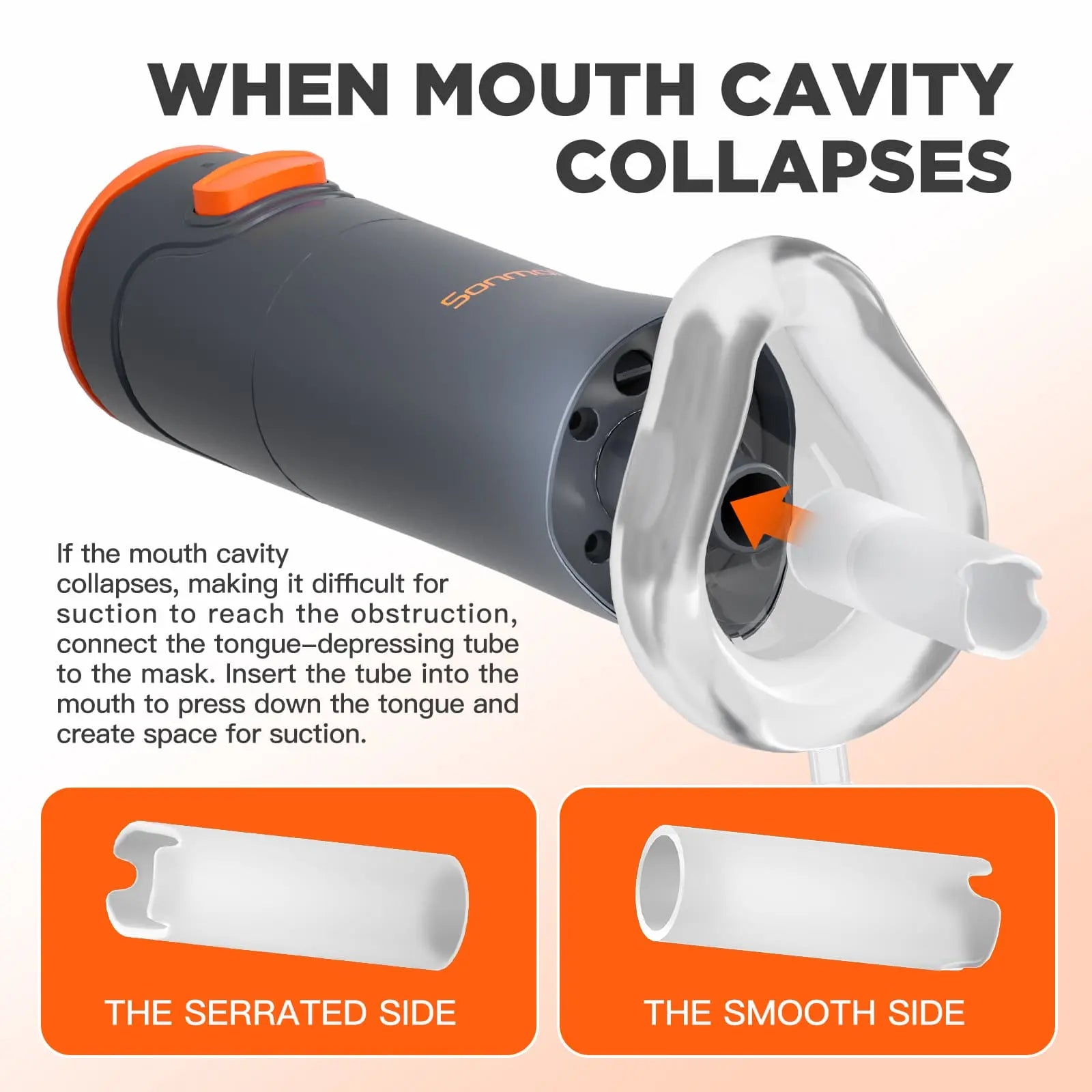 Sonmol Anti-Choking Device Portable My Store