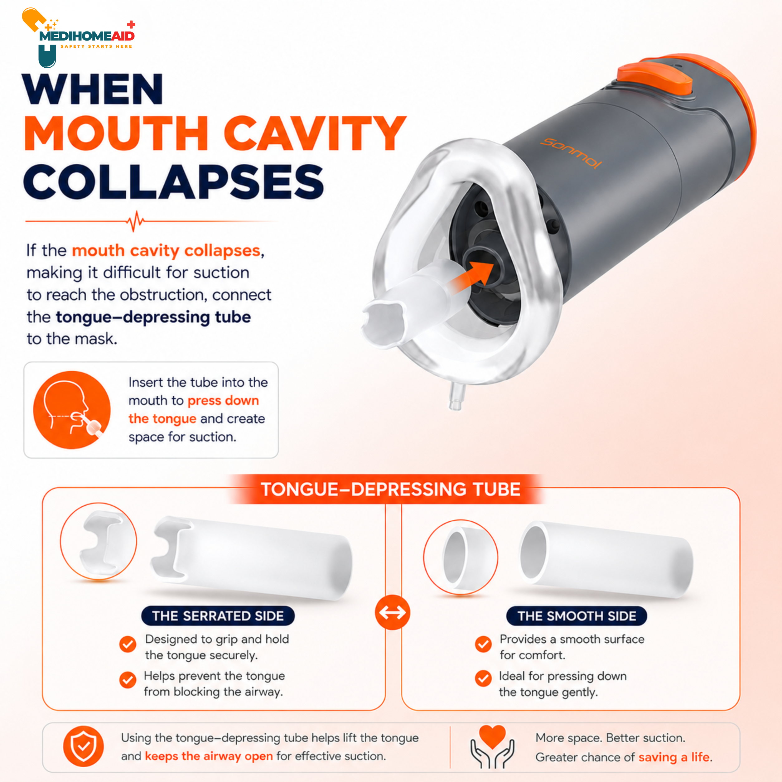 Sonmol Anti-Choking Device — medi Mouth Cavity Collapses